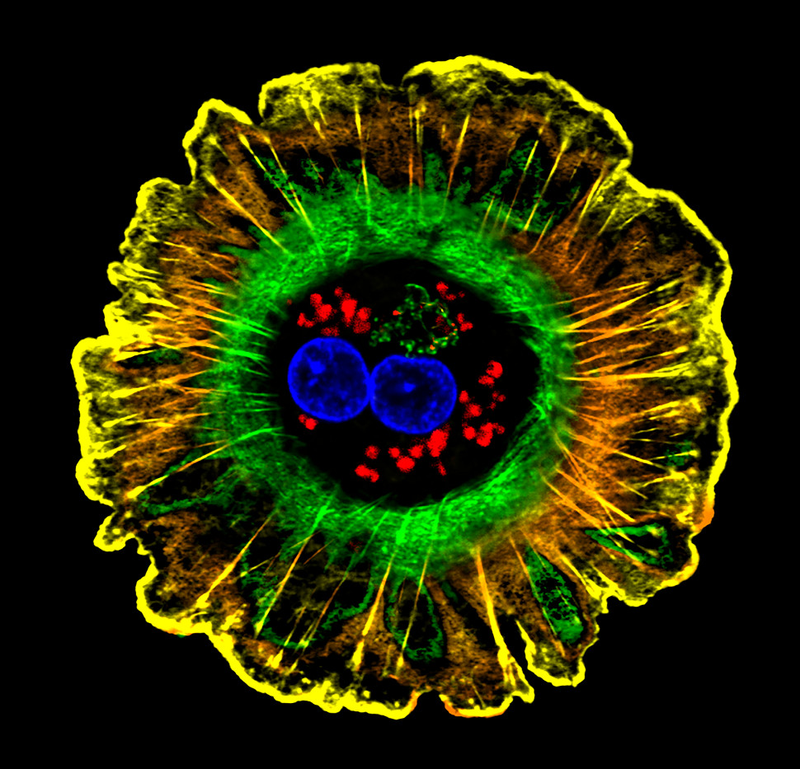 Illustration for article titled The Astounding And Horrific World As Seen Under A Microscope